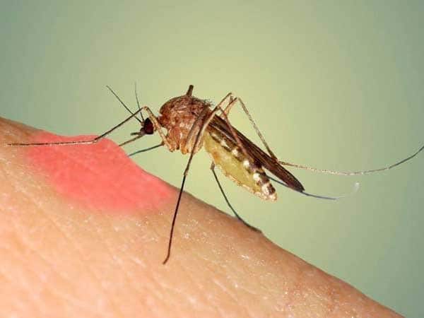 Muỗi cắn bị bầm tím