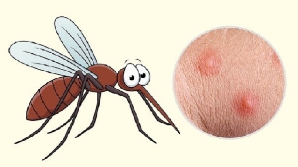 Bị muỗi đốt làm sao cho hết sưng ở trên da?